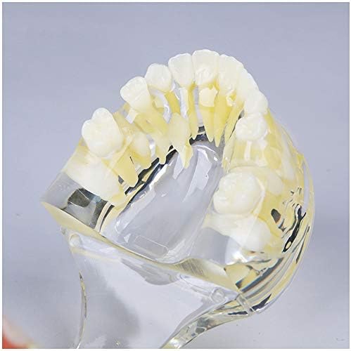 Modelo de retentor de dentes decíduos KH66ZKY - Modelo de dentes padrão odontológico - Ferramenta de demonstração de escovação de