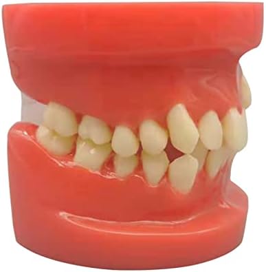 Modelo Ortodôntico KH66ZKY - Modelo de dente de má oclusão - Modelo de demonstração ortodôntica Ensino de Typodont, estudando,