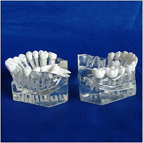 Modelo de dentes de demonstração dental kh66zky com dentes removíveis para ensinar e estudar coleção