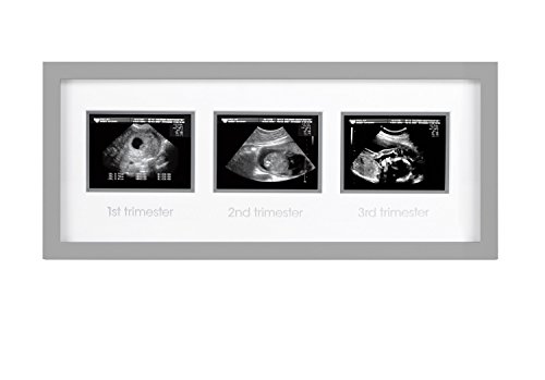 Moldura de imagem do sonograma triplo de Pearhead, gravidez com moldura fotográfica, decoração de berçário de bebê neutro em termos de gênero
